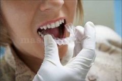 Alcordental 