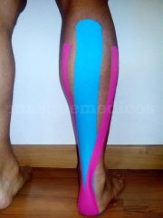 Vendaje neuromuscular - Elizabeth Vázquez Galván