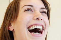 Sonríe! - Clínica Janer Ortodoncia