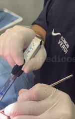 anestesia electronica sin dolor - Clínicas Verdi