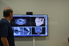 Radiología dental - Instituto Dental Bosch