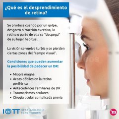 Desprendimiento de retina - Instituto Oftalmológico Tres Torres