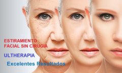 Ultherapia - Dr. Galo Mauricio Solano Quinde