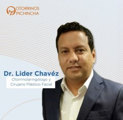 Lider Arcenio Chavez Franco