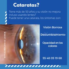 Cataratas oculares  - Diana Stephanie Parra Rodríguez