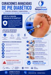 Pie Diabetico GUAYAQUIL  - Shirley Mora