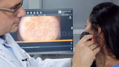 Dermatoscopia - Canarias Dermatológica