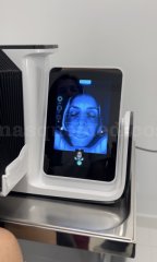 MEDICINA ESTÉTICA Analizador facial - AKRO: Medicina, fisioterapia y readaptación