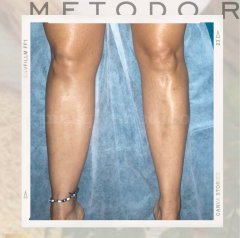 Drenaje linfático corporal  Brasileño Renata França - Centro Masaje Drenaje Linfático Manual Renata França