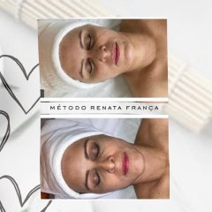 Drenaje linfático facial  Brasileño Renata França - Centro Masaje Drenaje Linfático Manual Renata França
