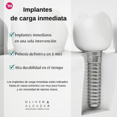 Implantes de carga inmediata - Oliver & Alcázar