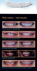 Snap-on Smile - Rosa Maria Rojo Lopez