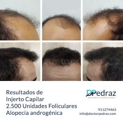 Javier Pedraz Muñoz - Javier Pedraz Muñoz