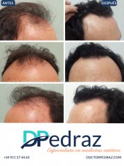 Javier Pedraz Muñoz - Javier Pedraz Muñoz