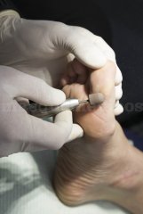 Podología deportiva. - Premium Health & Sport