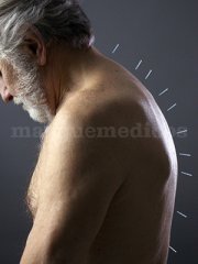 Fisioterapia Vicetto