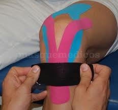 Kinesiotape - Fisiovisan