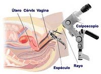 Citología Vaginal y Colposcopía Ginecologogica - Juan Betancor Jiménez