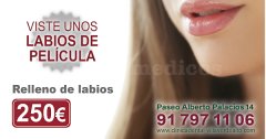 Relleno de Labios - Estética Villaverde Alto
