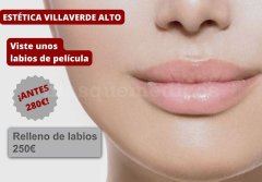 Relleno de Labios - Estética Villaverde Alto