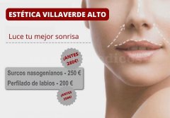 Surco Naseeniano - Estética Villaverde Alto