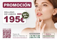 Relleno de Labios - Estética Villaverde Alto