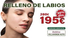 Relleno de Labios - Estética Villaverde Alto