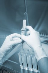 Factores de Crecimiento IMTRA Clinica en Madrid España INCOMA Enrique Galindo Andujar  - Instituto Madrileño de Traumatología