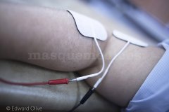 Rehabilitacion de traumatologia fisioterapia fisioterapeutas fisio-pilates Madrid Imtra  - Instituto Madrileño de Traumatología