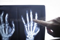 Doctor Enrique Galindo Andujar Traumatologia Madrid España - Instituto Madrileño de Traumatología
