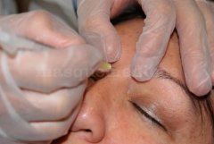 Centro Dermatológico Dr. Galváñ