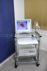 Equipo Fotofinder Desmoscope - Clínica Dermatológica Clemente