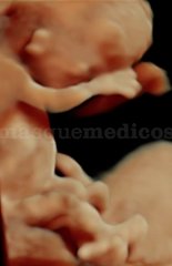 De 6 a 20 semanas - César Uguet