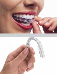 Ortodoncia invisible - Clínica Abad