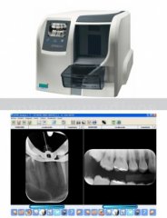Radiología digital - Clínica Abad