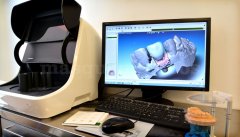 Últimas tecnologías en prótesis dentales - Adana Dental