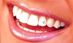 Piercing dental - Clínica Dental Rambla