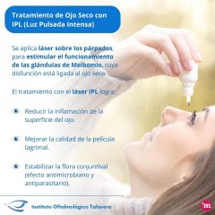Tratamiento de Ojo Seco con IPL (Luz Pulsada Intensa) - Instituto Oftalmológico de Talavera
