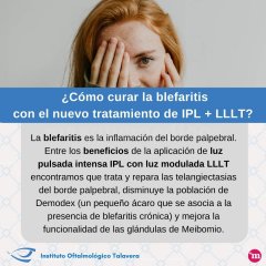  ¿Cómo curar la blefaritis con el nuevo tratamiento de IPL + LLLT? - Instituto Oftalmológico de Talavera