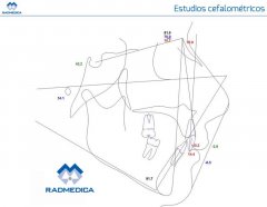 Estudio cefalométrico - RADMEDICA