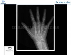 Estudio RX Mano-Pulso - RADMEDICA