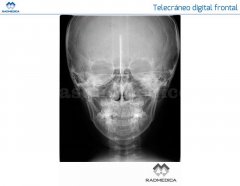 Telerradiografía frontal digital - RADMEDICA