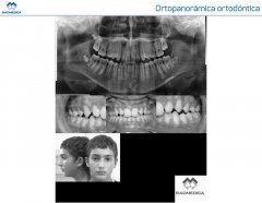 Ortopanorámica ortodóntica - RADMEDICA
