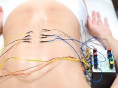Electroacupuntura - Alejandro Amor Soriano