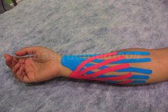 Fisio3Cantos