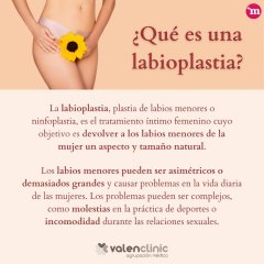 Labioplastia - Valenclinic Agrupación Médica