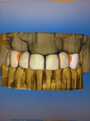 ·3D dental - Clínica Cots