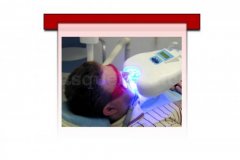 Blanqueamiento dental - Clínica Dental Antonio Sala
