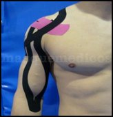Kinesiotaping - Juan Pablo Díaz