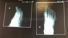 José Antonio Capacés Viamonte